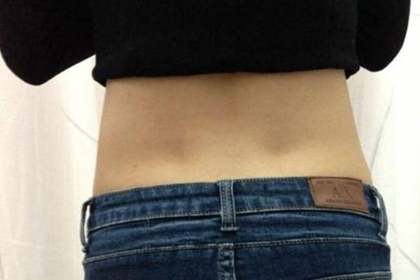 女性的后腰上长有两个凹点是什么少数人才有为什么