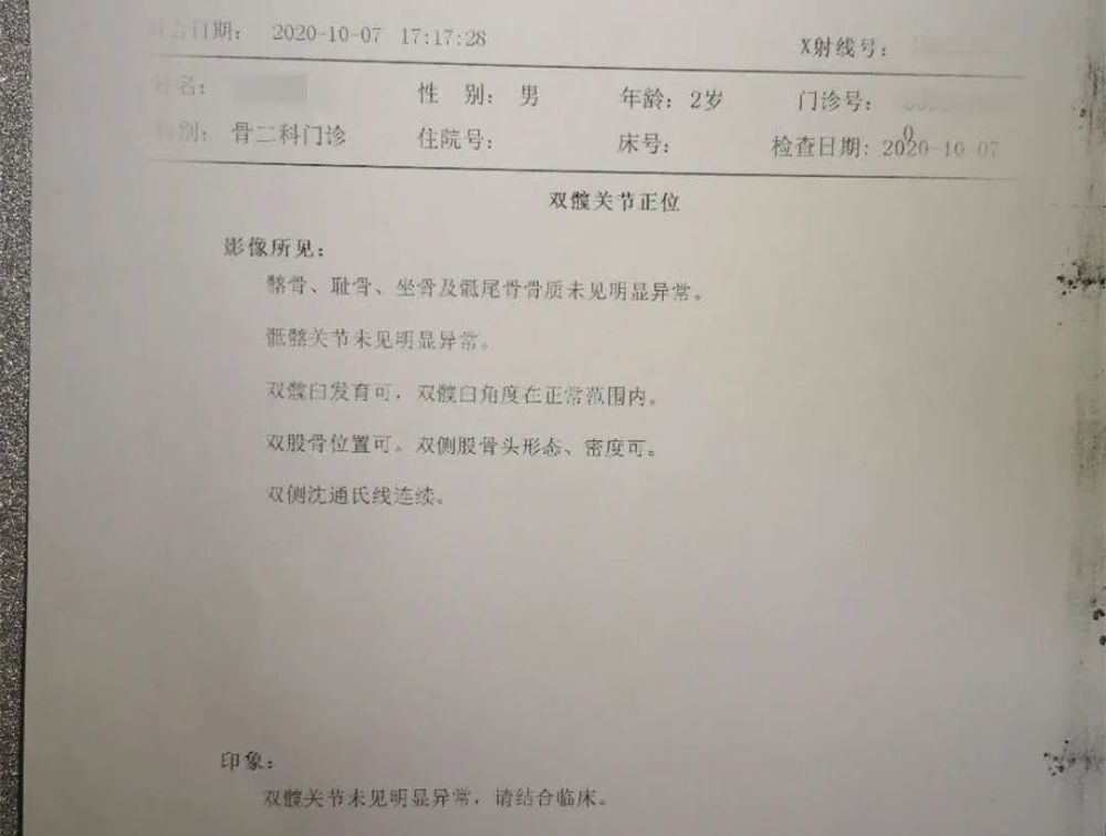 怎样才能痊愈?只需静养吗?1. 滑膜炎是什么原因引起?