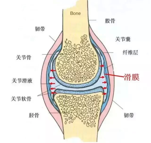 膝關節滑膜炎的症狀有哪些