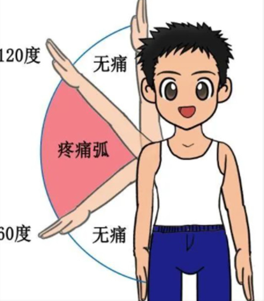 肩膀痛除了肩周炎还有可能是这个原因