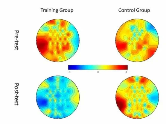 训练组经过训练后的大脑变化与对照组的对比