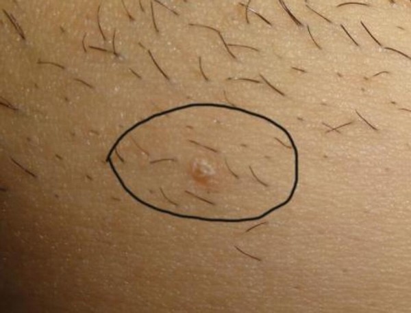 女性必须知道的一个坏消息:hpv长时间不转阴,会面临2大疾病_腾讯新闻