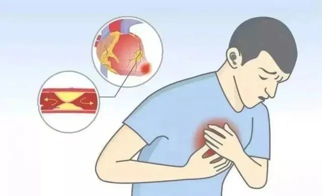 34岁男子,凌晨入院,心梗离世,年轻人一个行为很要命,早点改