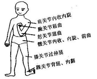 中风后改善肌肉张力是关键,针灸治疗可差异化改善肌张力的高低_腾讯新