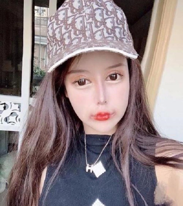 3年整60次,花数百万,网红女孩娜娜,如今吃饭睡觉都成了问题_腾讯新闻