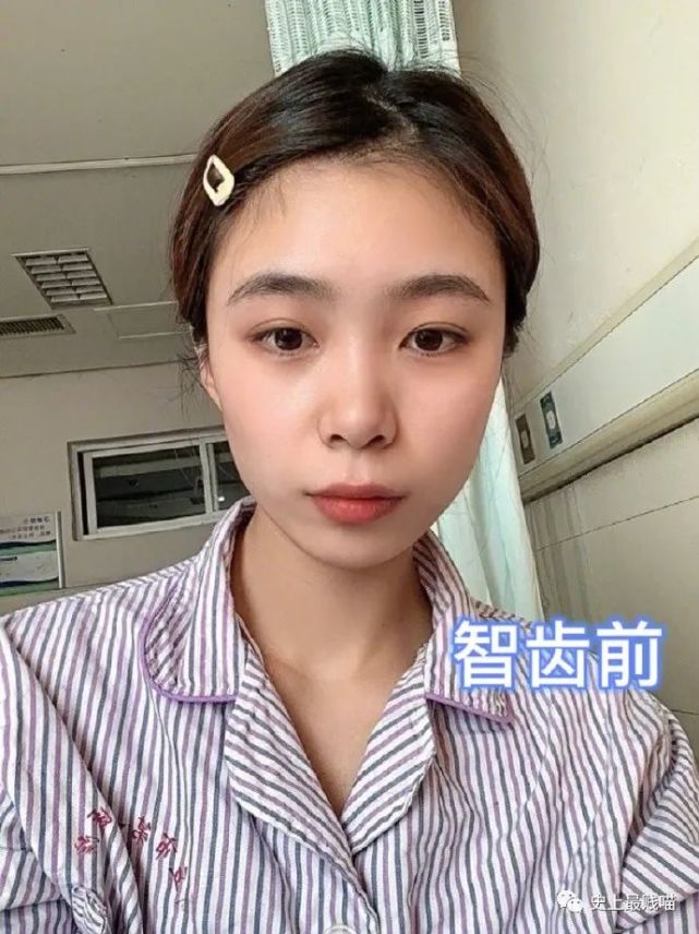 笑掉大牙|