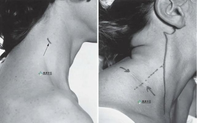 副神经概述与诊疗分析