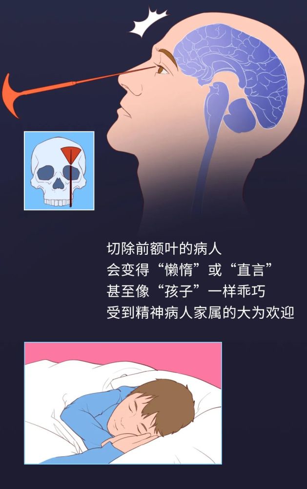 精神病|正常人不敢看的精神病治疗史：你能坚持看完吗？