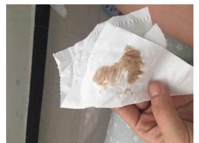 肺部出问题,痰液会给出"通知"?咳出5类痰液,或许应该多留意