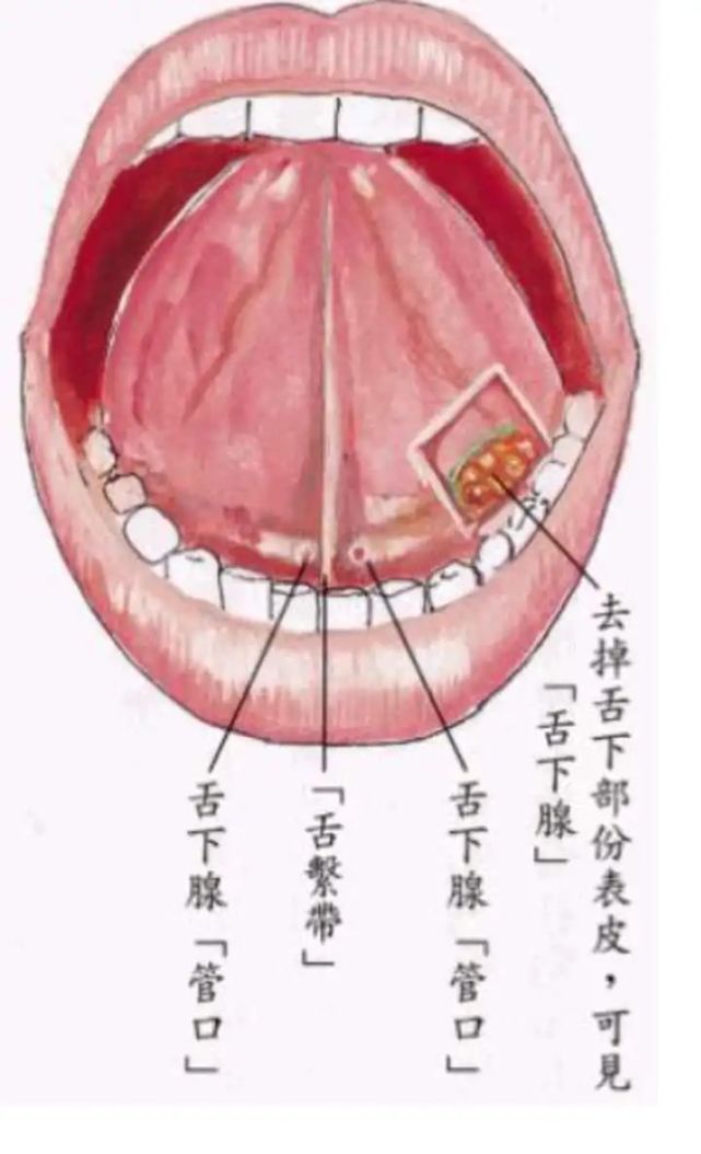 而如果持续拉下去,结果就是舌系带破裂了,然后出血.