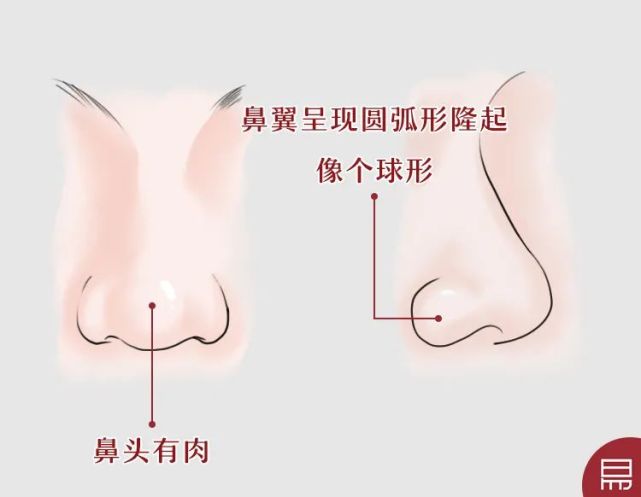 鼻頭有肉,鼻翼飽滿,而且鼻翼呈現圓弧形隆起,像個球形,正面看不掀露