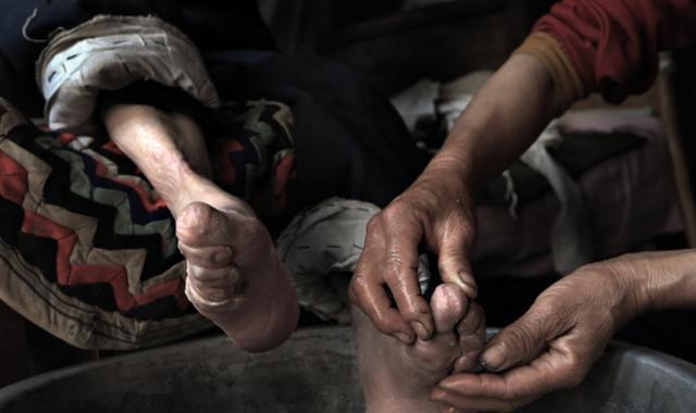 民国时期的小脚女人,15岁靠"三寸金莲"嫁大户,脚只有丈夫看过