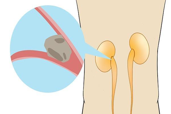 中风|中年人群，哪些疾病出现率极高？身体上有不适的症状要重视