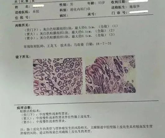 查出来肠上皮化生怎么办