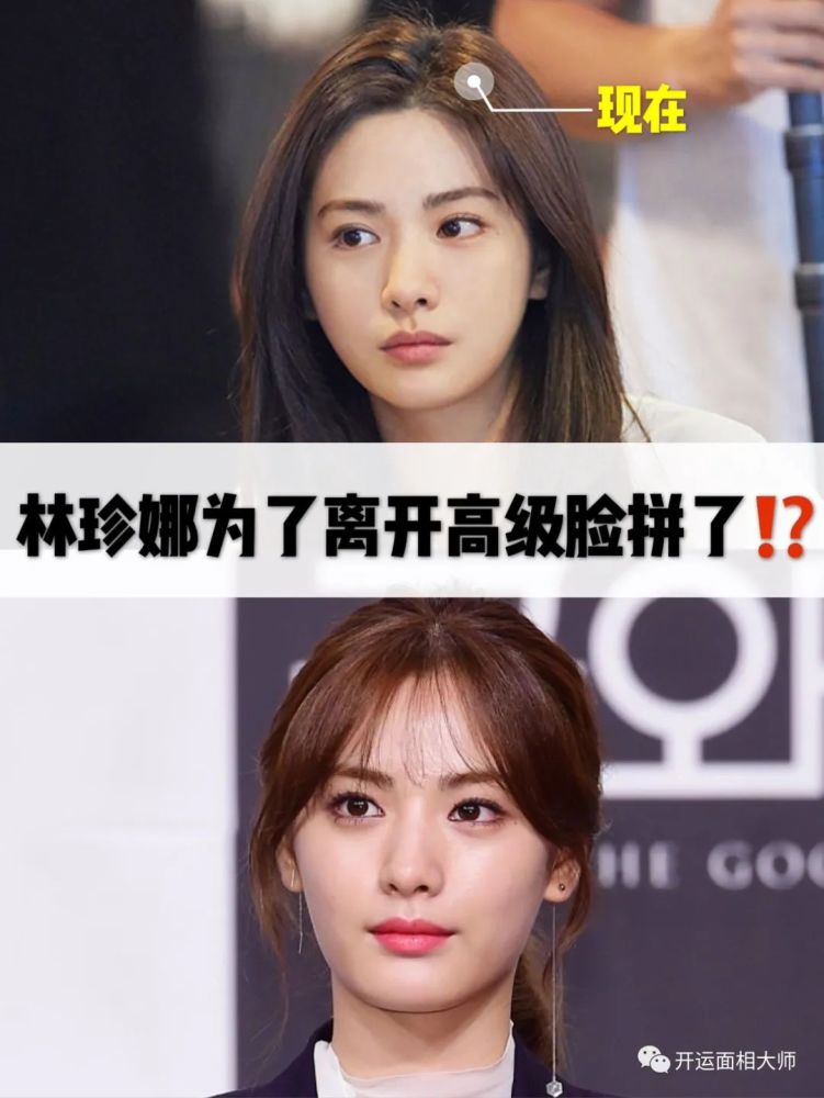 韩国千年美女林珍娜nana做了颧骨缩小整形变脸 高级感全无 腾讯新闻