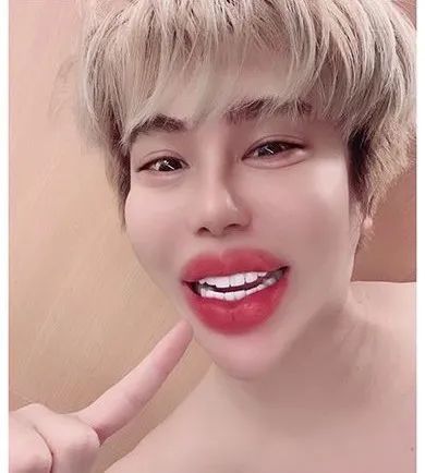 日本帅小伙靠富婆金主扶持整容花了一个亿却变成了青蛙脸