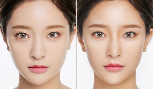 5个鼻部美学标准,教你如何做出完美好看的鼻子!