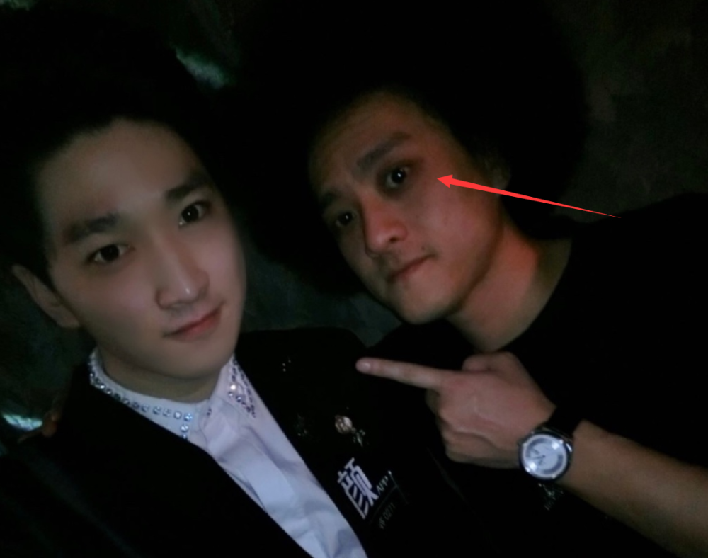 43岁赵英俊去世好友公开生前合影黑眼圈太吓人最后一条朋友圈曝光