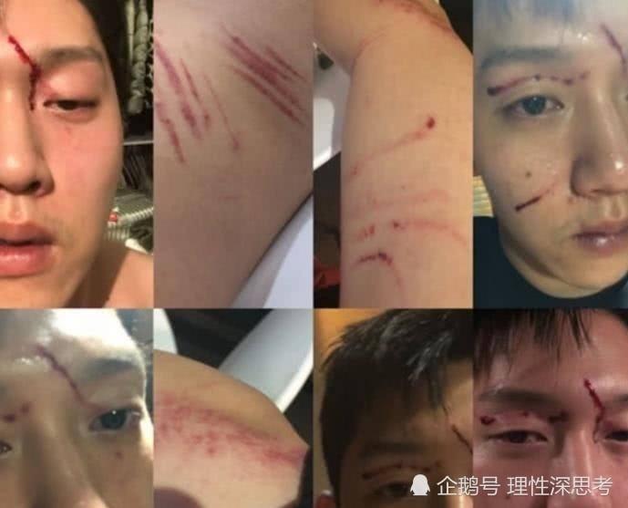 家暴是如何开始的你知道吗