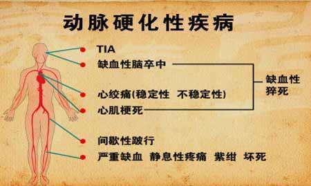 動脈硬化吃什麼好多吃這些食物就能軟化血管