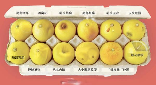 乳腺癌成全球最常见癌症男性也要小心无法预防该咋办