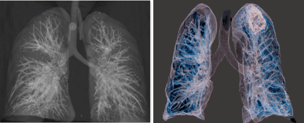 水合物|氙气和疝气到底有什么区别？作为神秘元素的它在疫情中大显身手