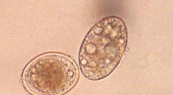 蛔虫到底有多可怕?