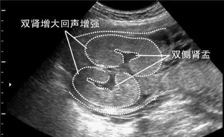 通过以上详细分析大排畸如何看男女,还在好奇胎儿性别的准妈妈们可以