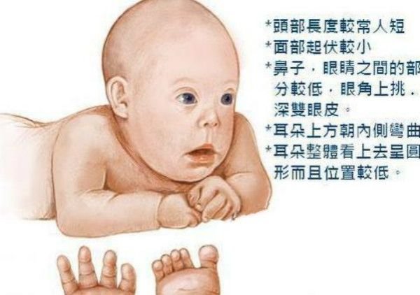 唐宝宝婴儿时期的表现图片