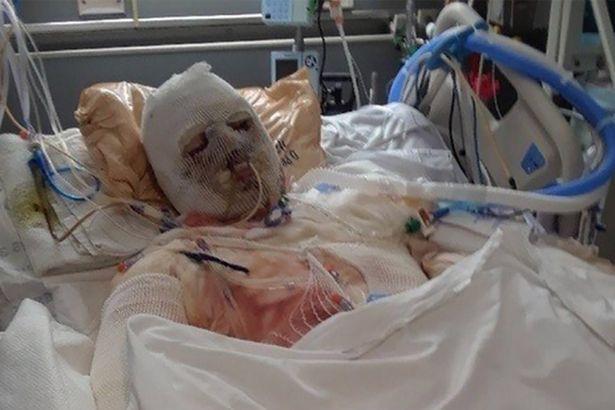 eduardo rodriguez)告诉《纽约邮报》,乔接受过20次整形手术,但由于