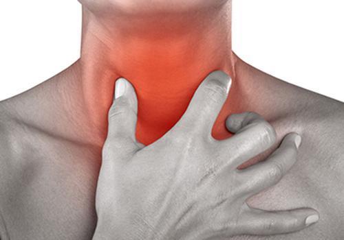 急性咽喉炎|咽炎|慢性咽喉炎|咽喉