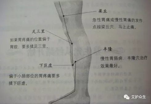 除膝关节外上方的梁丘外,急性胃性时,在足阳明胃经小腿部经线上还经常