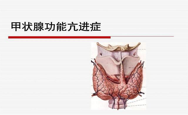 甲亢|身体的5种变化，可能是甲亢的早期信号，若有符合，早点重视！