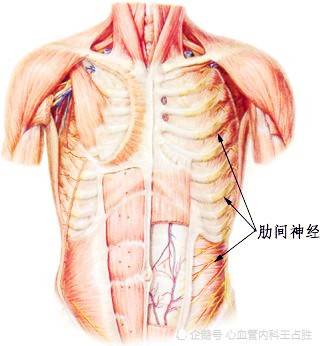 肋间神经痛图片位置图片
