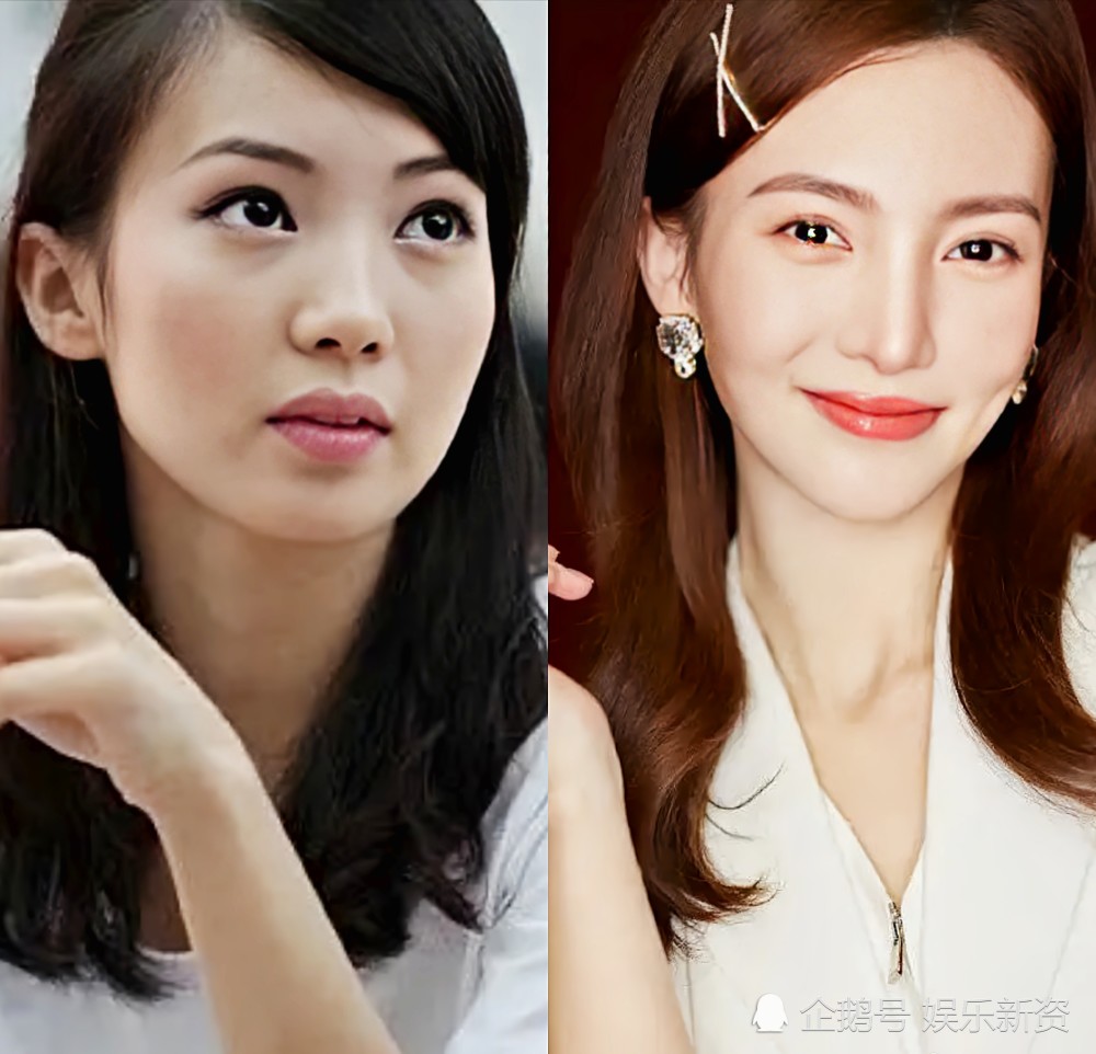 与旧照对比,金晨在北舞时期是真的自然清新呀,现在的鼻子虽然高挺,但