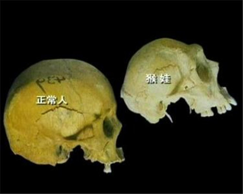 猴娃|三峡猴娃是不是野人？猴娃的六大变异，20年来科学都难以给出解释