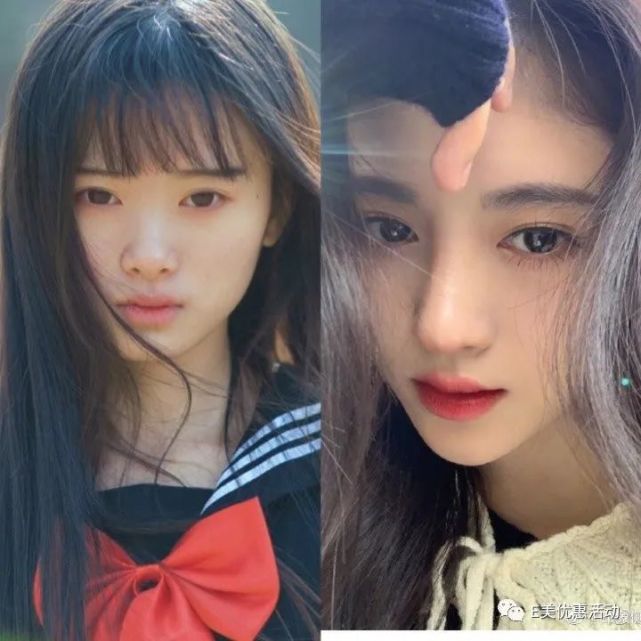 大家都知道鞠婧祎整容,但有谁知道她在哪家整形医院整的呢?