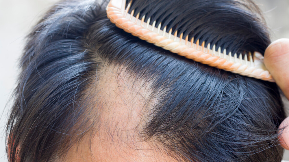 尿毒症|45岁男子腰痛难忍，检查出尿毒症，医生叹息：常喝一种饮料伤肾严重