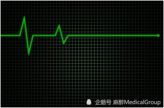 不是所有的心脏停跳都需要除颤有时可能在帮倒忙