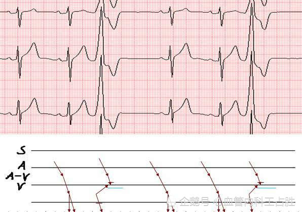 心慌都是心脏病 拉肚子也可以 很多人都不知道 腾讯新闻