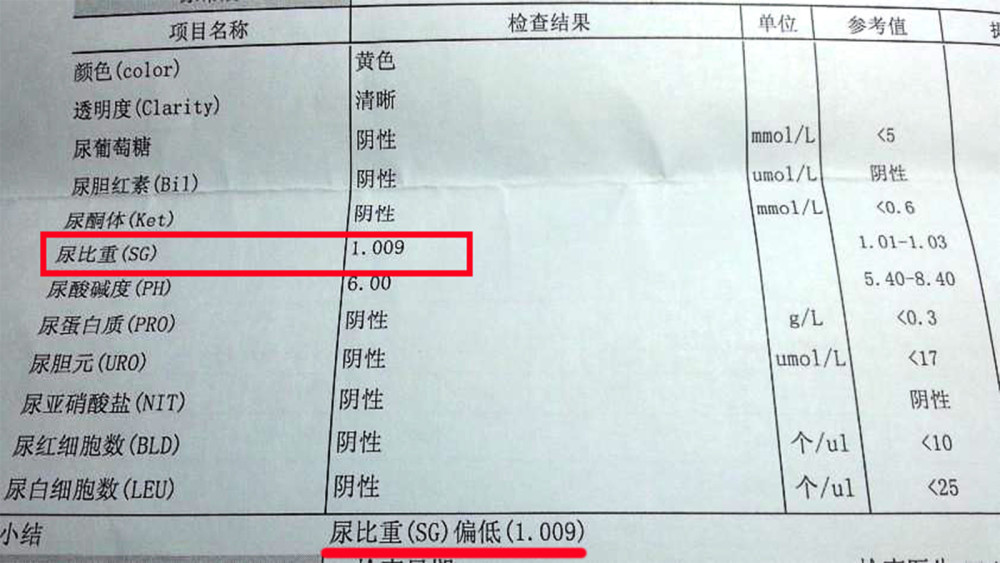 高血压患者|高血压患者怎样判断是否出现了肾损害？