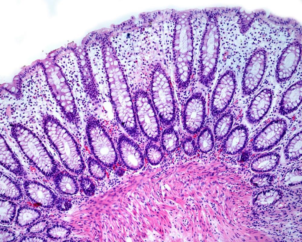 过敏|经常皮肤过敏？只有找到过敏的“罪魁祸首”，我们才能告别过敏