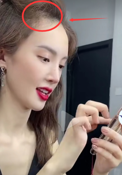 金晨忘带假发,脑门豁了一块,看清真实发量,玉米须都不敢说比这秃