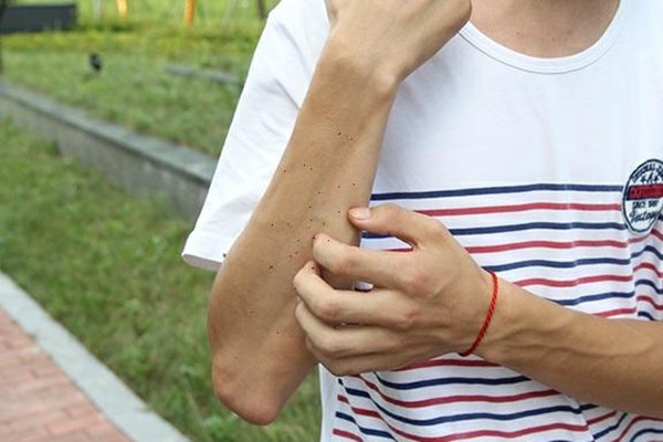 人类免疫缺陷病毒|感染上艾滋病毒，早期身体会有什么异常？该如何预防？医生回答