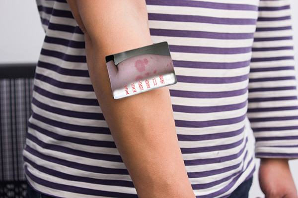 人类免疫缺陷病毒|感染上艾滋病毒，早期身体会有什么异常？该如何预防？医生回答