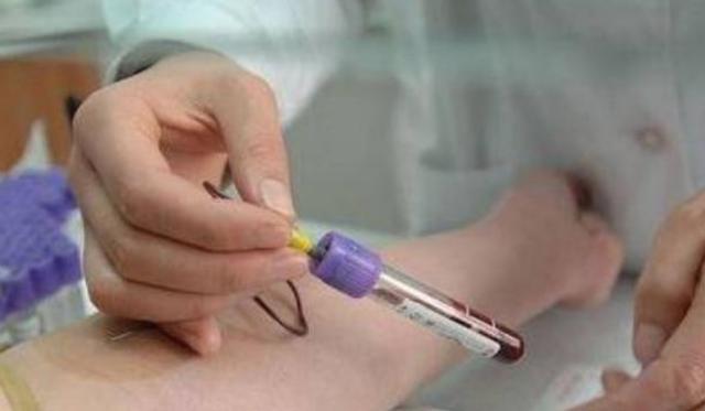 他汀类药物|长期服用他汀类药物，需要做什么检查？多长时间查一次合适？