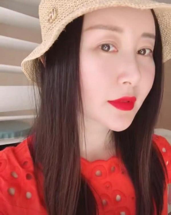 33岁舒畅近照曝光面部浮肿僵硬显得头大身小变化太大认不出