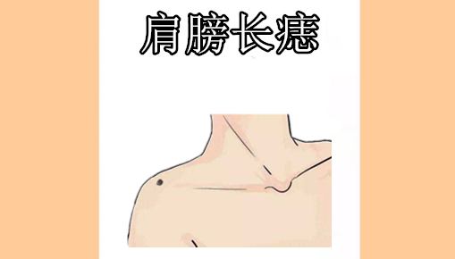脸上4颗"劳碌"痣,打一辈子工,双脚停不下,手里没钱没房!_腾讯新闻