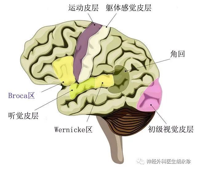 失语症|卒中后失语症