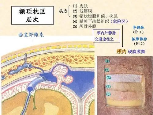 头皮的解剖层次决定头皮针不能直接改善肢体功能针灸治疗中风后遗症